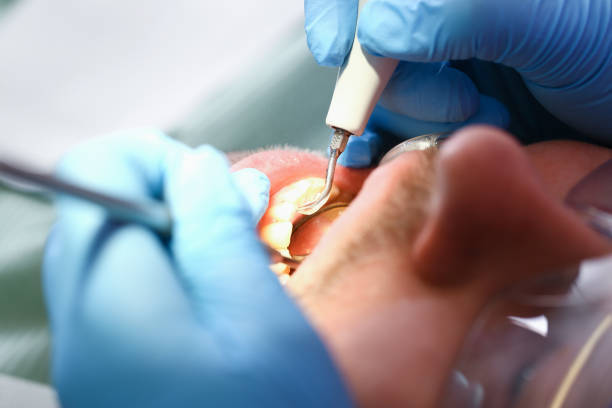 Fast & Reliable Emergency Dental Services in RI