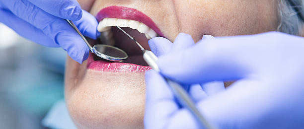 Best Holiday Emergency Dentist in Chepachet, RI